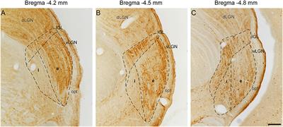 Aging Alters Daily and Regional Calretinin Neuronal Expression in the Rat Non-image Forming Visual Thalamus